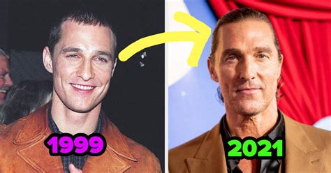 Matthew McConaughey Denies Getting A Hair Transplant