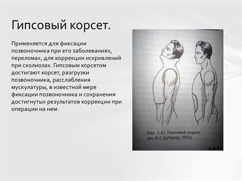 Виды гипсовых повязок - презентация онлайн