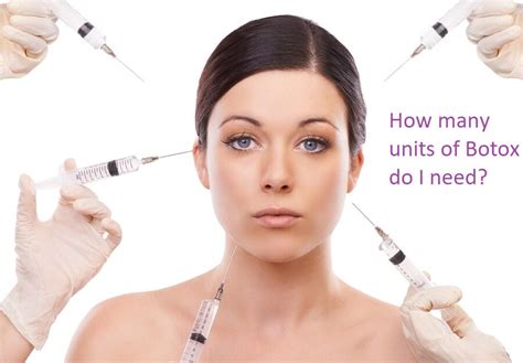 How many units of Botox do I need?