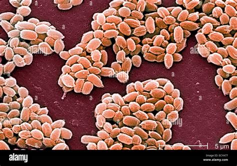 photomicrograph  bacillus anthracis anthrax spores stock photo alamy