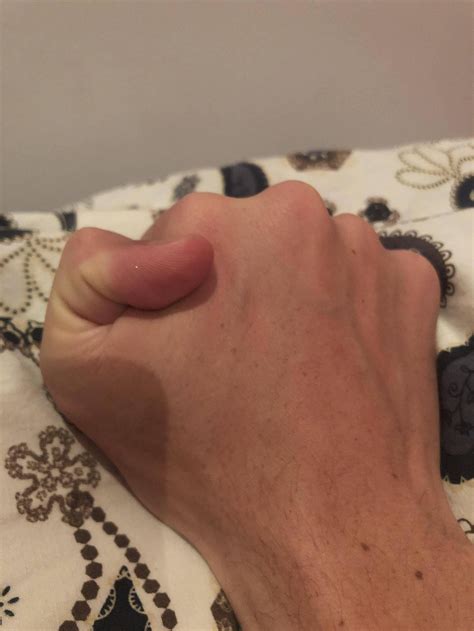 I have double jointed thumbs and can bend them really far back : r
