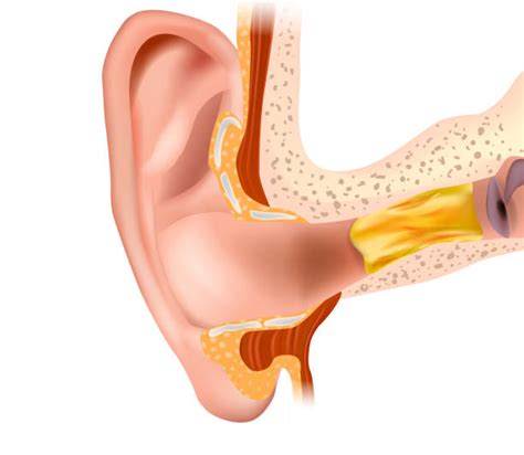 250+ Earwax Stock Illustrations, Royalty-Free Vector Graphics & Clip