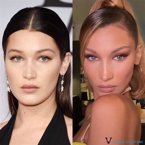 Asymmetrical Face Correction