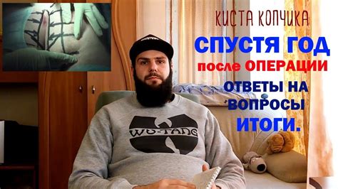Спустя год. Киста копчика.Копчиковый ход. / Pilonidal cyst. Surgery. My ...