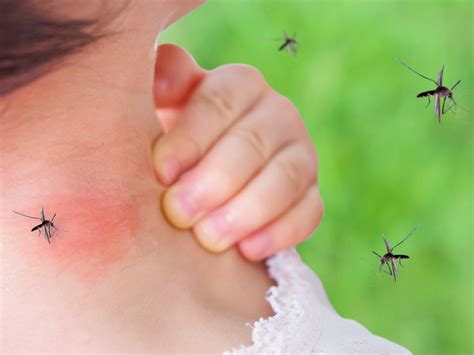 What is dengue? Know why is it widespread and how long it takes to ...
