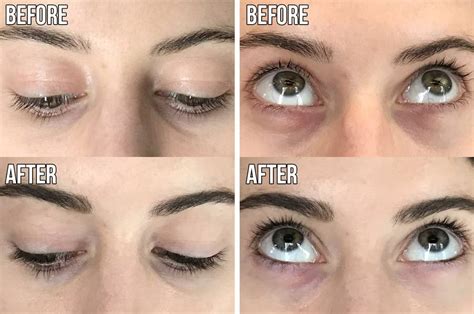 The Ordinary Lash Serum Review | tunersread.com