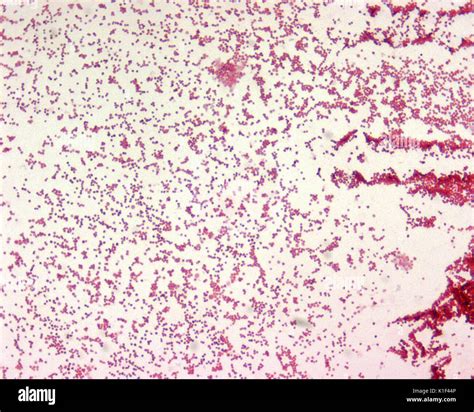 Francisella tularensis is Gram-negative in its staining morphology ...
