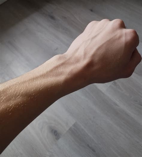1190 best Broken Bones images on Pholder | Neverbrokeabone ...