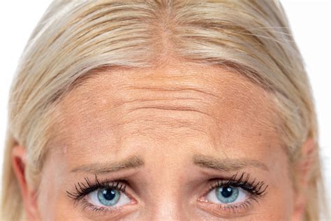 forehead images browse  stock  vectors  video