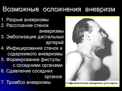 Аневризмы брюшного отдела аорты - презентация онлайн