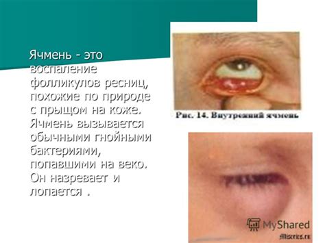 Презентация на тему: "Болезни глаз ВЫПОЛНИЛА: СТУДЕНТКА 4 КУРСА ФАБ(ПП ...