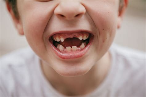 When do kids start losing teeth? Expert guide to baby teeth