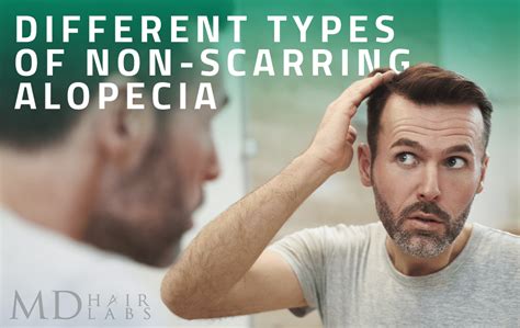 Different Types of Non-Scarring Alopecia • MD Hair Labs