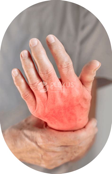 Bangalore’s Best Rheumatoid Arthritis Treatment | Plexus