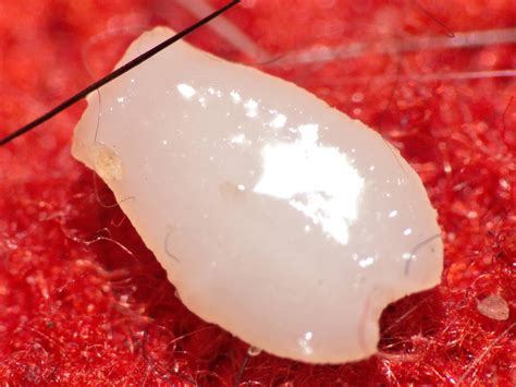 What kind of cat parasite is this worm? - Pets Stack Exchange