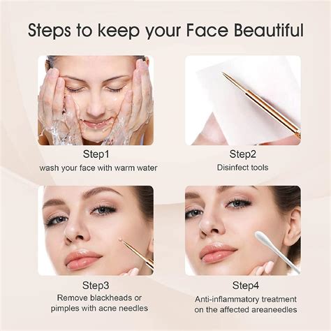 newest blackhead removal videos 2023 loan nguyen 8