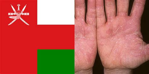 Skin Disease in Oman