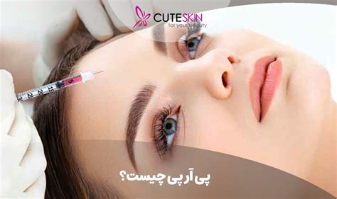 پی آر پی چیست؟ تزریق PRP یا پلاکت درمانی چقدر موثر است!؟ - کیوت مگ ...