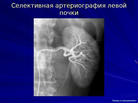 Презентация Ангиография