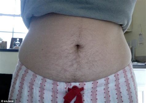 Real women display their bellies: XO Jane Real Girl Belly Project ...