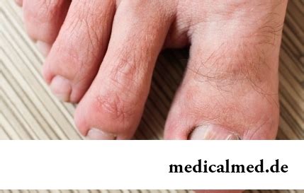 Genyantrum – the Dictionary of medical terms