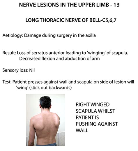 Instant Anatomy - Upper Limb - Nerves - Nerve Lesions - Long thoracic nerve