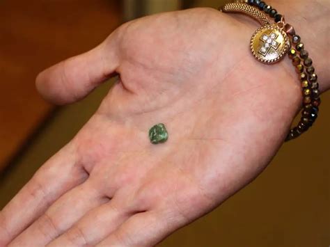 The Hidden Truth: 5 Silent Signs A Lump May Be Cancer