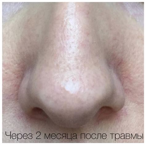 Cellgel® (Цельгель®)