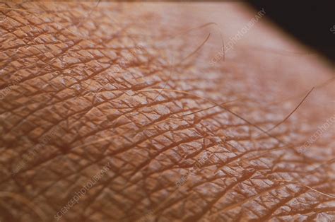 skin surface stock image p science photo library
