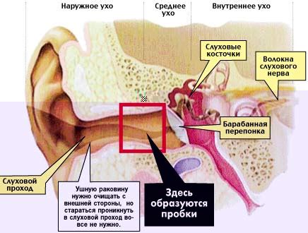 Серная пробка