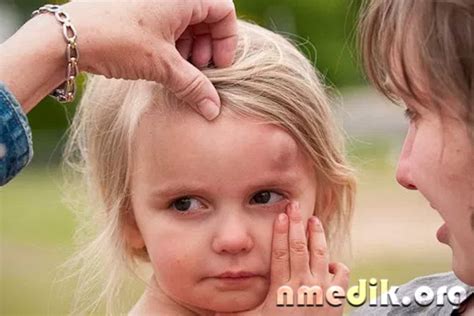 Шишка На Лбу Фото — Фото Картинки