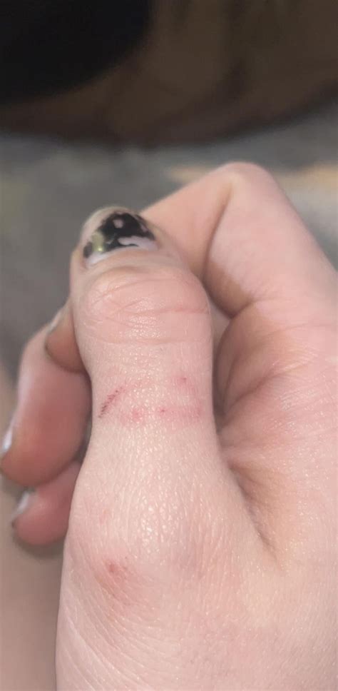 GUESS THE LIZARD BITE! : r/reptiles