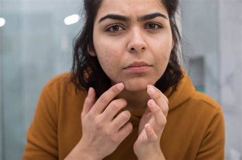 female chin hair        health