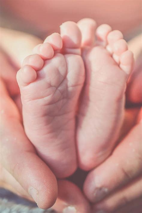 What Is Clubfoot? - Klarity Health Library