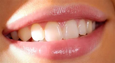 What do we know about teeth? - Digital lesson - Mozaik Digital Learning