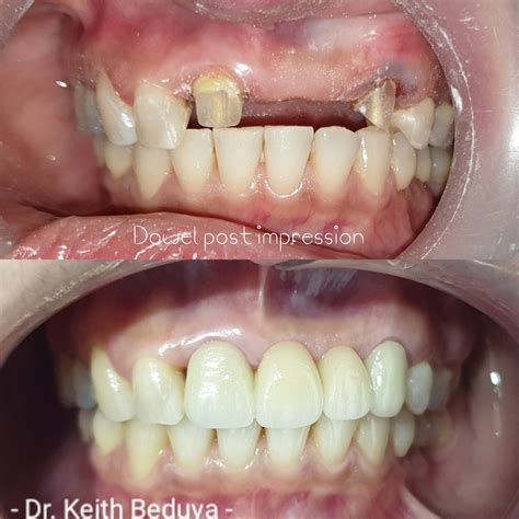 Beduya Dental | Comprehensive Dental Care in Manila – Specializing in