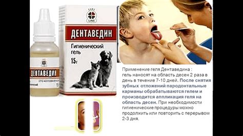 Дентаведин ВЕТЕРИНАРНЫЙ - для обработки полости рта - YouTube
