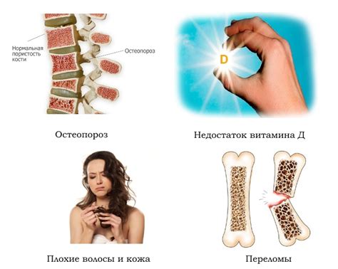 Кальцепан — инструкция по применению, цена, отзывы, аналоги