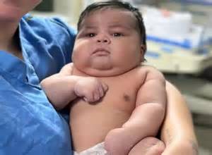 Bebê de 6,5 kg nasce de parto normal no ES; mãe e filho sofrem sequelas