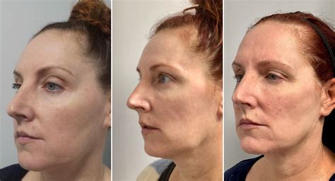 سایت آغاز نو: Before & After Photos Will Leave You Speechless! Image 18