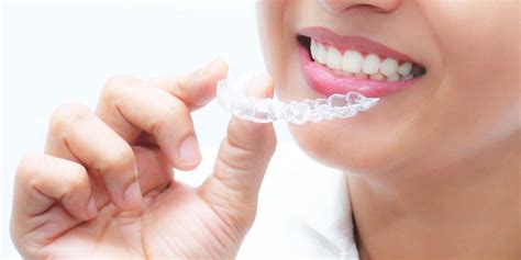 Removable Invisible Aligners | Partha Dental Clinic 130+