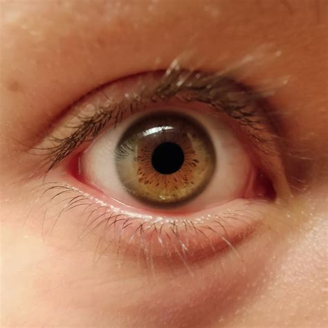 Is this central heterochromia ? Also, is it that rare to have that ? I ...