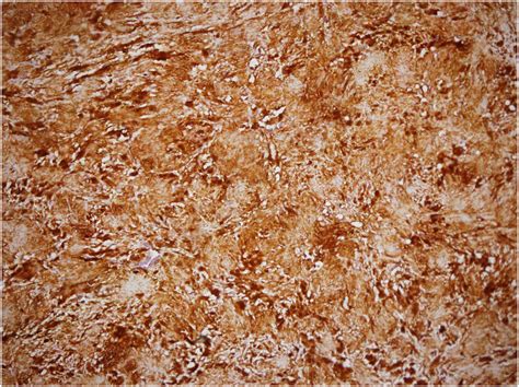 ihc staining    positive  scientific diagram