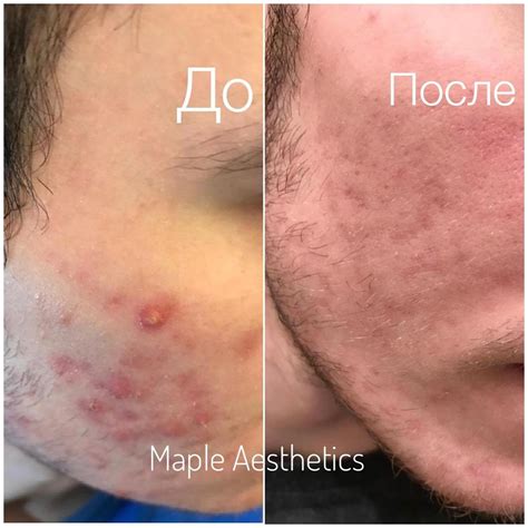 Maple Aesthetics - Home