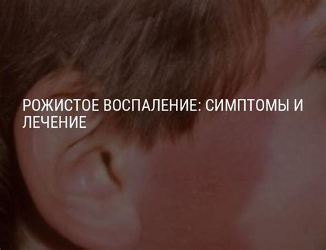 Рожистое воспаление — симптомы и лечение, признаки рожи и формы ...