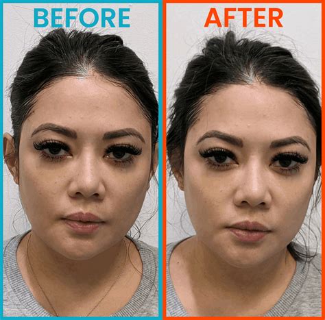 Himynameistee: Before And After The Leak