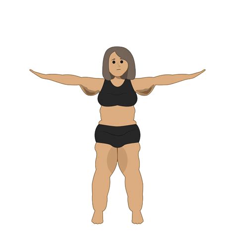 lipedema-concept-design-woman-with-lipedema-desease - Body Health Brasil