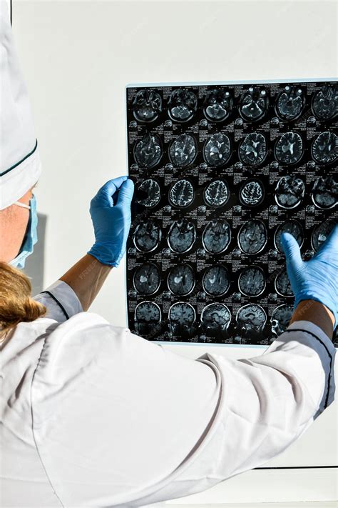 Premium Photo | Doctor in protecting gloves holding brain mri in