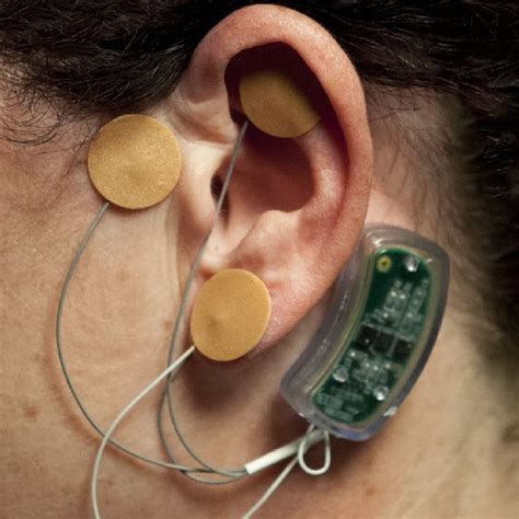 Assembled Neuro-Stim System? device. | Download Scientific Diagram