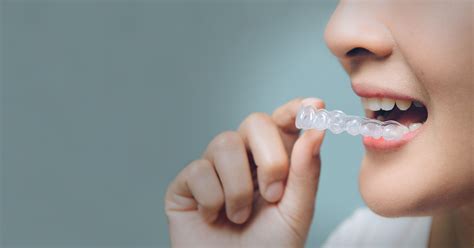 Clear Aligners in East Brunswick, NJ | Summerhill Dental Excellence